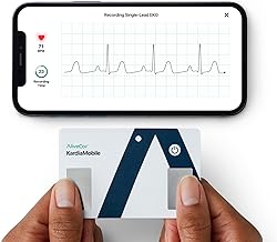 Best ekg machine